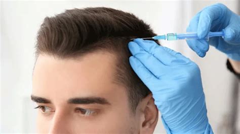 De Stappen Van Een Haartransplantatie Proces