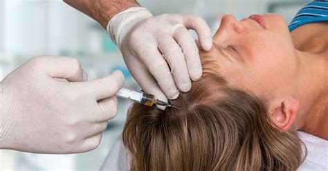 Haartransplantatie En Genetica: Wat Zegt De Onderzoek?