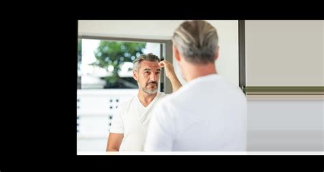 Haartransplantaties Bij Vrouwen: Wat Je Moet Weten