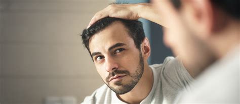 Haaruitval Bij Mannen: Wat Zijn De Beste Behandelingen?