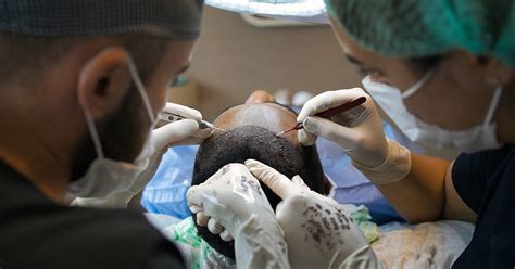 Verschillende Methoden Van Haartransplantatie Behandeling