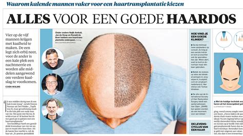 Waarom Haartransplantatie De Toekomst Van Haarherstel Is